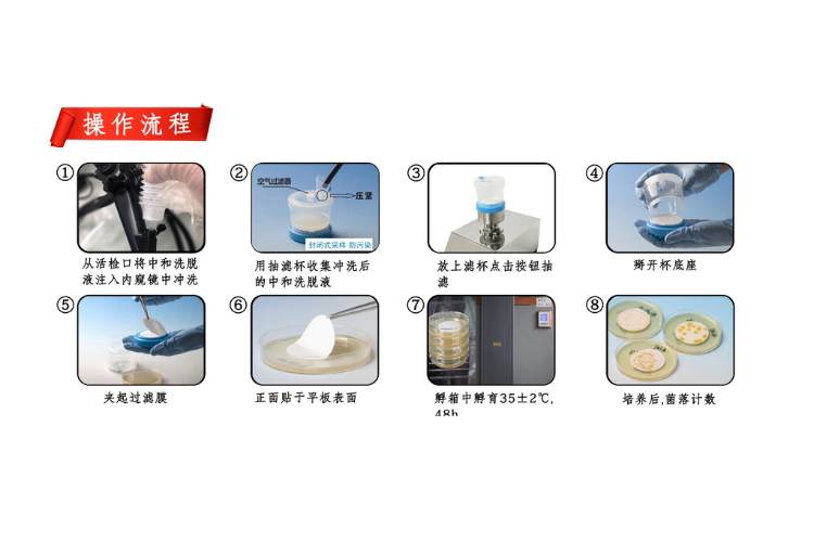 1704185307310378.jpg 內(nèi)鏡操作步驟.jpg